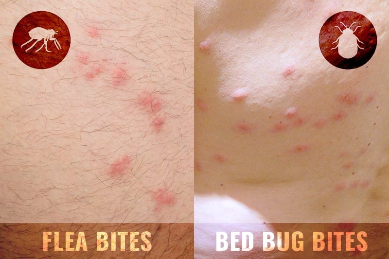 Fleas VS Bed Bugs: What’s The Difference?